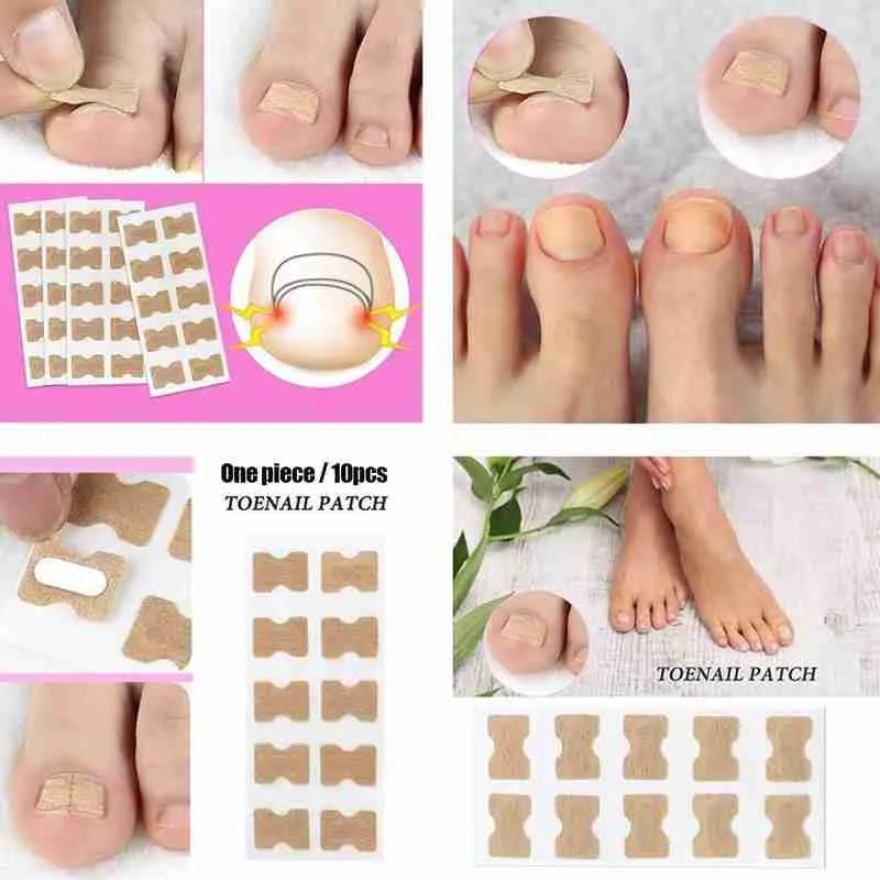 Glue Free Toenail Patch