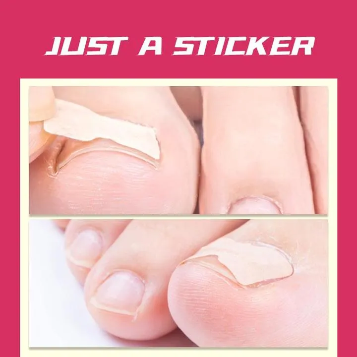 Glue Free Toenail Patch